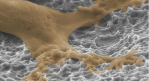 Titan Spine Initiates Full U.S. Launch of nanoLOCK Surface Technology