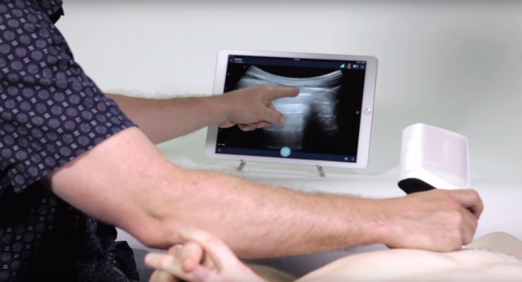 Wireless, Smartphone Ultrasound Scanner a Safe Alternative to X-Ray for Lung Scanning