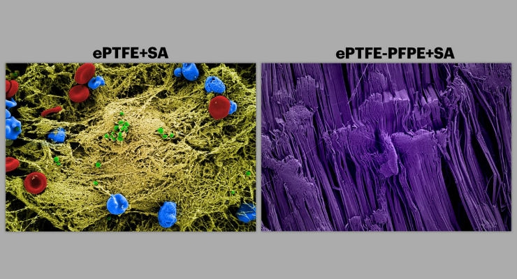 Slippery Implant Coating Protects Against Infectious Biofilm Formation