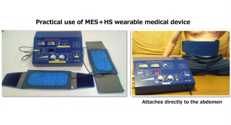 Wearable for Type 2 Diabetes Delivers Mild Electrical Stimulation and Heat Shock