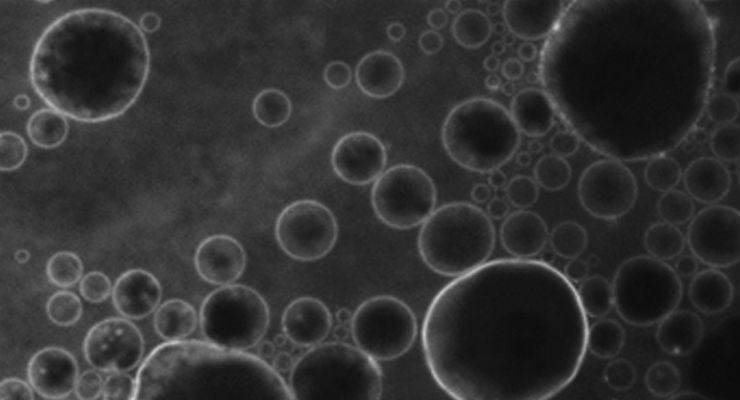 Microbubbles and Ultrasound Open Blood–Brain Barrier to Administer Drugs