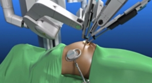 World’s First Magnetic Scarless Robotic Gallbladder Surgery