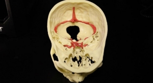 Mount Sinai Establishes 3D Printing Services for Clinicians and Researchers
