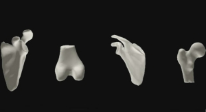 Interactive 3D Human Joint Models to Provide Insights into Common Orthopedic Complaints