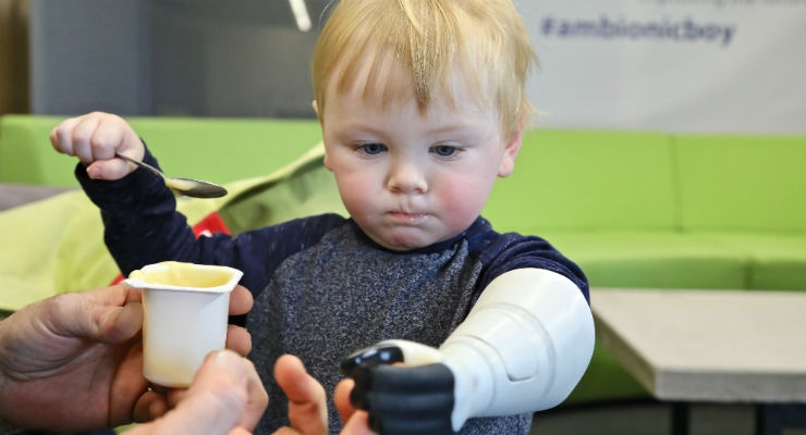 Father Develops 3D-Printed Prosthetic Arm for Two-Year-Old Son