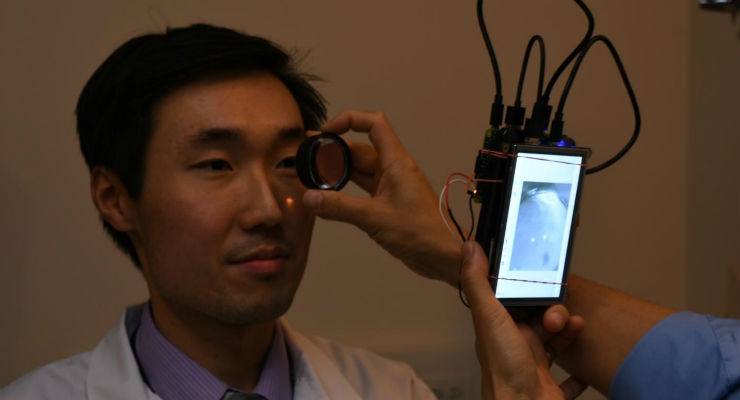 Pocket-Sized Retina Camera Requires No Eye Dilation