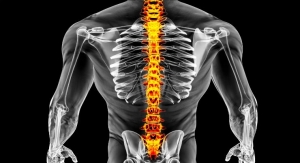 InVivo to Initiate Cervical Spinal Cord Injury Study