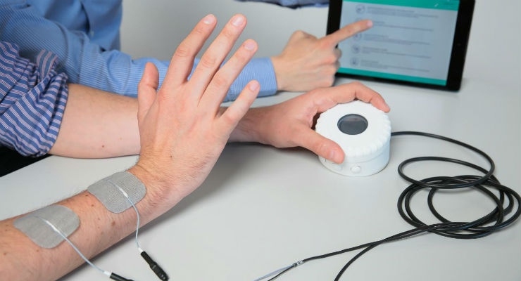 Stroke Rehabilitation: Use of electrical stimulation to help arm