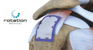 Bioinductive Rotator Cuff Implant Brings Reduced Pain, Faster Return to Activities