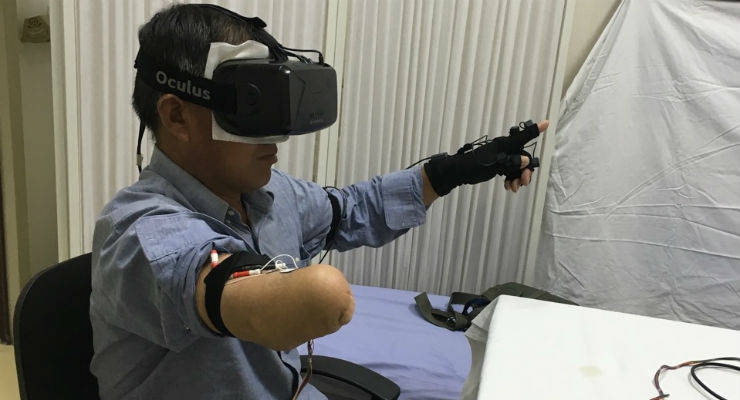 Virtual Reality Eases Phantom Limb Pain