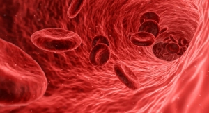 3D Printed Patch Guides Growing Blood Vessels
