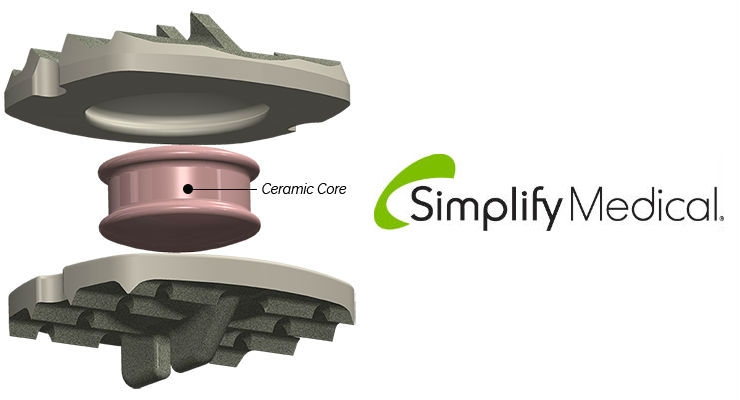 Simplify Medical Closes $21M Financing for Cervical Artificial Disc