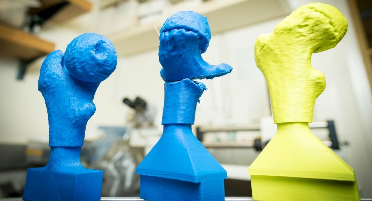 3D Printing Helps Shorten Pediatric Hip Surgery Times