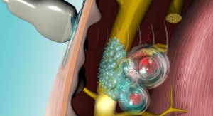 Ultrasound-Triggered Liposomes for On-Demand, Local Anesthesia