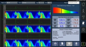 HeartScience Gains CE Mark for MyoVista High Sensitivity ECG Device