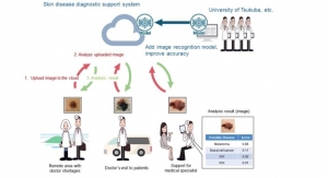 Kyocera-University Collaboration Working on AI-Digital Skin Cancer Analysis Tool