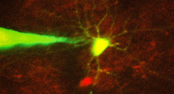 Robotic System Monitors Specific Neurons