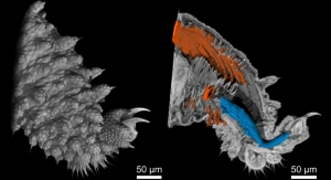 Nano-CT Device Could Spot Microscopic Development of Illness