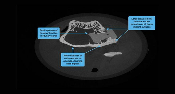 Osteoconductive PEEK Composite for Spinal Implants