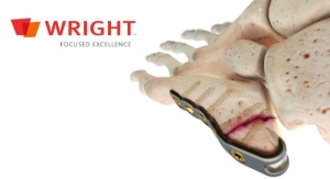 Wright Medical Launches ORTHOLOC 3Di Small Bone Plating System