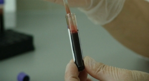 Single Blood Test Screens for Eight Cancer Types 