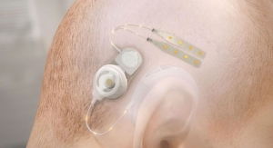 Wyss Center and CorTec Partner on Minimally Invasive Brain Stimulation and Recording System