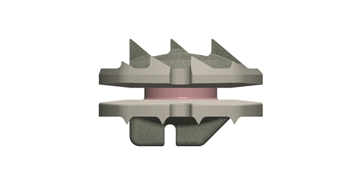 Simplify Medical Receives 50th Patent for Cervical Disc Replacement Portfolio