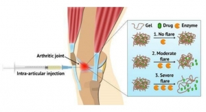 Flare-Responsive Hydrogel Developed to Treat Arthritis