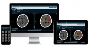 Oxford Spinout Brainomix Secures Investment to Tackle Strokes with AI