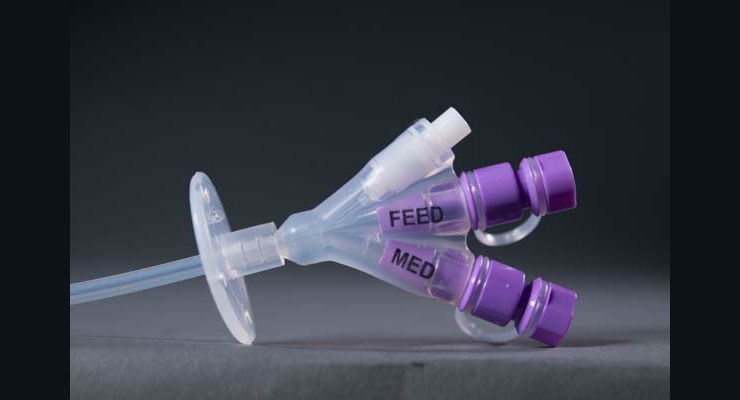 Mastering Matings: Reengineering the Enteral Feeding Luer Connector