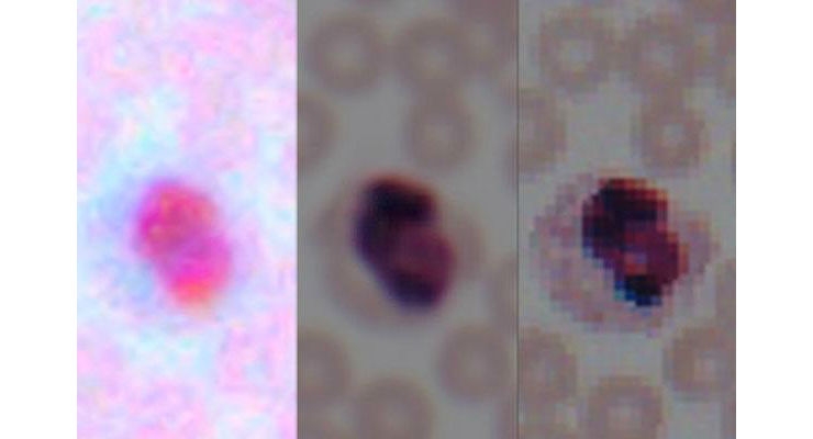 Deep Learning Transforms Smartphone Microscopes into Laboratory-Grade Devices
