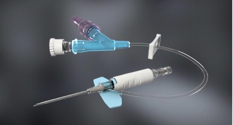 Smiths Medical Announces U.S. Launch of the DeltaVen Closed System Catheter and FDA Clearance 