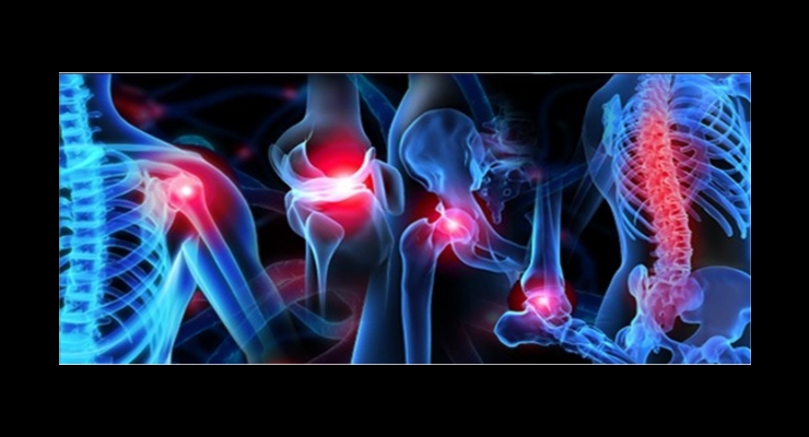Orthopedic Trauma Devices Market Expected to Account for $14 Billion by 2028