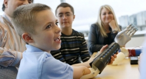 First U.S. Clinical Trial of 3D Printed Bionic Arms for Children Begins
