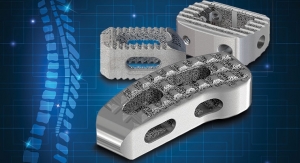Built to Last: A Roundtable on Orthopedic Implant Manufacturing 