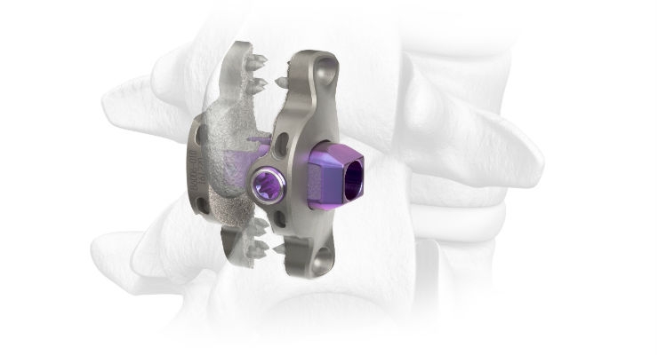 Spinal Elements Initiates Expanded Release of Its Clutch Interspinous Process Device