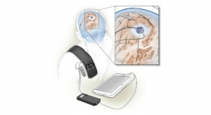 Self-Tuning Brain Implant Could Help Treat Parkinson