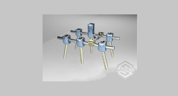 SAGICO Receives FDA 510(k) Clearance for its Pedicle Screw OSI Spinal System