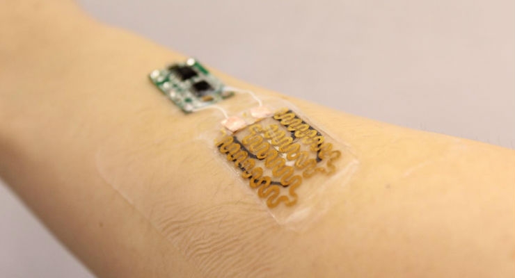 Smart Bandages Monitor and Tailor Treatment for Chronic Wounds