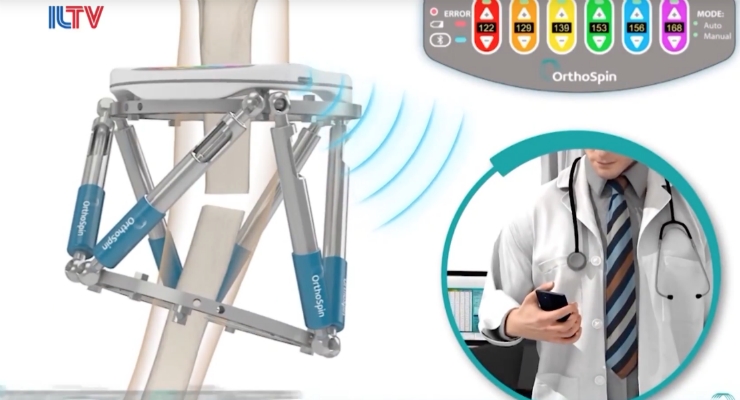 OrthoSpin Raises $3M for Smart Robotic External Fixation System