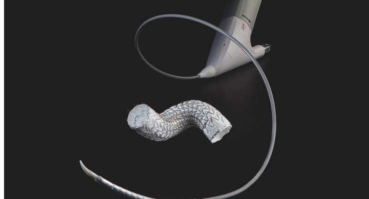 Gore Announces First In-Human Use of GORE TAG Conformable Thoracic Stent Graft 