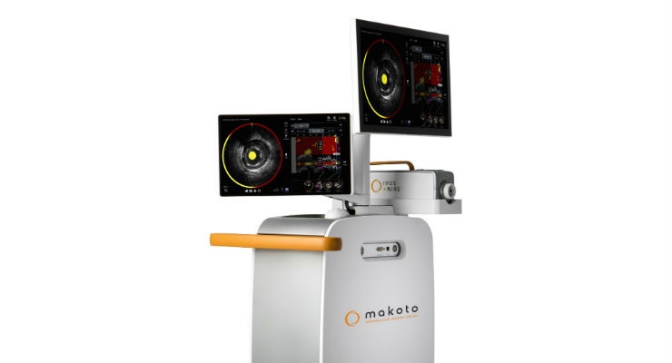 Infraredx Launches Makoto Intravascular Imaging System in Japan