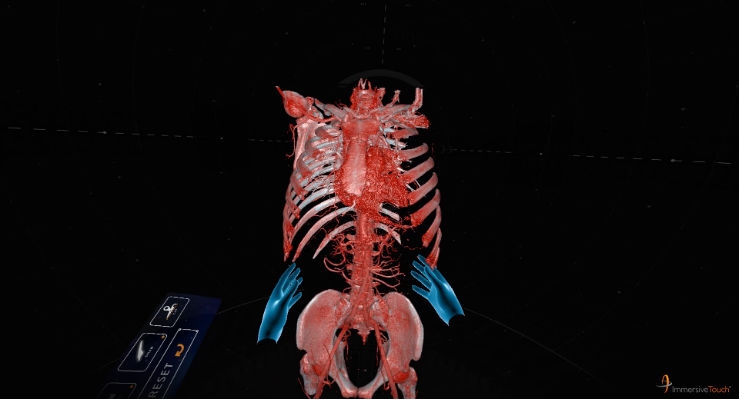 NASS News: ImmersiveTouch Launches New Solutions for Personalized Virtual Reality Surgical Imaging