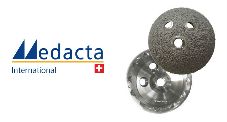Medacta Adds 3D Metal Implants and Augments to Mpact System for Hip Surgery