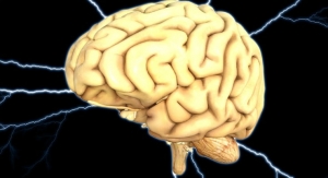 Deep Brain Stimulation for Alzheimer’s Not for Everyone