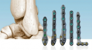 In2Bones Launches CoLink Afx Ankle Fracture Repair System