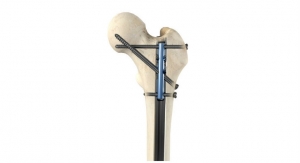 OrthoXel Orthopaedic Trauma Device Co. Receives CE Mark Clearance for Apex Femoral Nailing System