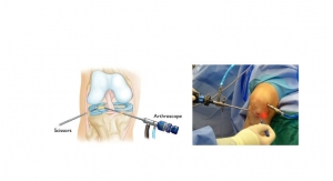 Meniscus Repair Systems Market Expected to Grow 8.7 Percent Through 2028