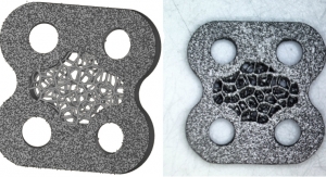 Intentional Design of Surface Roughness for Orthopedic Parts