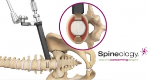Spineology Releases Duo Angled Instrumentation System